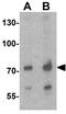 ATM Interactor antibody, GTX31920, GeneTex, Western Blot image 