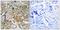 Sodium Channel Epithelial 1 Beta Subunit antibody, LS-C822949, Lifespan Biosciences, Immunohistochemistry frozen image 