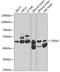 tRNA-splicing endonuclease subunit Sen2 antibody, GTX32940, GeneTex, Western Blot image 