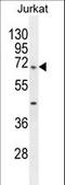 TBC1 Domain Family Member 3H antibody, LS-C203705, Lifespan Biosciences, Western Blot image 