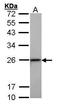 Transgelin antibody, PA5-27463, Invitrogen Antibodies, Western Blot image 