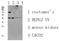 C-C Motif Chemokine Receptor 5 (Gene/Pseudogene) antibody, STJ99606, St John