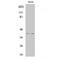 Interferon-inducible protein AIM2 antibody, LS-C381956, Lifespan Biosciences, Western Blot image 