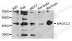 MAGE Family Member C2 antibody, A8217, ABclonal Technology, Western Blot image 