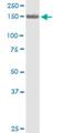 Polycystin 2, Transient Receptor Potential Cation Channel antibody, H00005311-M01, Novus Biologicals, Western Blot image 