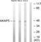 A-Kinase Anchoring Protein 5 antibody, GTX87532, GeneTex, Western Blot image 