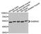 Gamma-Aminobutyric Acid Type A Receptor Alpha5 Subunit antibody, orb374299, Biorbyt, Western Blot image 