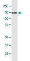 Tripartite Motif Containing 33 antibody, H00051592-M01, Novus Biologicals, Western Blot image 