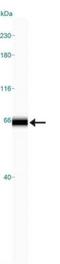 5'-Aminolevulinate Synthase 1 antibody, NB100-56415, Novus Biologicals, Western Blot image 