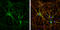 Microtubule-associated protein 1B antibody, GTX133209, GeneTex, Immunocytochemistry image 