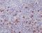Integrin Subunit Alpha E antibody, M07091, Boster Biological Technology, Immunohistochemistry paraffin image 