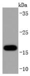 Superoxide Dismutase 1 antibody, NBP2-67158, Novus Biologicals, Western Blot image 