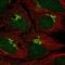 Tumor Protein P73 antibody, NBP2-58523, Novus Biologicals, Immunofluorescence image 