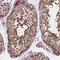 Autophagy Related 16 Like 1 antibody, NBP2-49408, Novus Biologicals, Immunohistochemistry paraffin image 