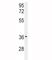 Insulin Like Growth Factor Binding Protein 3 antibody, F50625-0.4ML, NSJ Bioreagents, Western Blot image 