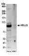 Helicase, Lymphoid Specific antibody, NB100-278, Novus Biologicals, Western Blot image 