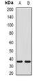 Short Stature Homeobox 2 antibody, abx142087, Abbexa, Western Blot image 