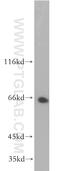 Sialophorin antibody, 13959-1-AP, Proteintech Group, Western Blot image 