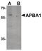 Amyloid Beta Precursor Protein Binding Family A Member 1 antibody, PA5-34418, Invitrogen Antibodies, Western Blot image 