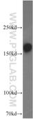 Glutamate Ionotropic Receptor NMDA Type Subunit 2B antibody, 21920-1-AP, Proteintech Group, Western Blot image 