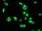 Bridging Integrator 2 antibody, LS-C672955, Lifespan Biosciences, Immunofluorescence image 