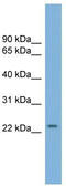 HMGE antibody, TA339367, Origene, Western Blot image 