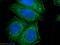 Phosphatase And Tensin Homolog antibody, 60300-1-Ig, Proteintech Group, Immunofluorescence image 