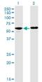 Protein Phosphatase 2 Regulatory Subunit B'Delta antibody, H00005528-M01, Novus Biologicals, Western Blot image 