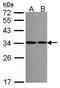 40S ribosomal protein S2 antibody, GTX114734, GeneTex, Western Blot image 
