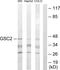 Goosecoid Homeobox 2 antibody, GTX87710, GeneTex, Western Blot image 