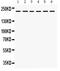 CD49D antibody, PB9648, Boster Biological Technology, Western Blot image 