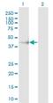 Carbohydrate Sulfotransferase 11 antibody, H00050515-M01, Novus Biologicals, Western Blot image 