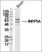 Inositol Polyphosphate-5-Phosphatase A antibody, orb184358, Biorbyt, Western Blot image 