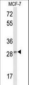Diacylglycerol Lipase Beta antibody, LS-C167265, Lifespan Biosciences, Western Blot image 
