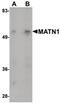 Matrilin 1 antibody, PA5-20725, Invitrogen Antibodies, Western Blot image 