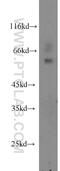 SWI/SNF Related, Matrix Associated, Actin Dependent Regulator Of Chromatin, Subfamily D, Member 2 antibody, 11156-1-AP, Proteintech Group, Western Blot image 