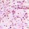 Treacle Ribosome Biogenesis Factor 1 antibody, orb304626, Biorbyt, Immunohistochemistry paraffin image 