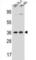 Leucine Zipper Protein 2 antibody, abx027259, Abbexa, Western Blot image 