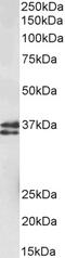 Syntaxin Binding Protein 3 antibody, 43-601, ProSci, Western Blot image 