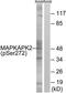 MAPK Activated Protein Kinase 2 antibody, TA312936, Origene, Western Blot image 