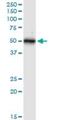 Keratin 16 antibody, H00003868-D01P, Novus Biologicals, Western Blot image 