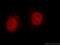 Metastasis Associated 1 Family Member 2 antibody, 66195-1-Ig, Proteintech Group, Immunofluorescence image 