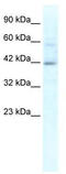 Potassium Channel Tetramerization Domain Containing 10 antibody, TA338717, Origene, Western Blot image 