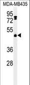 F-Box And Leucine Rich Repeat Protein 2 antibody, LS-C166074, Lifespan Biosciences, Western Blot image 