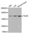 TAO Kinase 2 antibody, abx002393, Abbexa, Western Blot image 