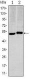 Carbonic Anhydrase 9 antibody, NBP1-51691, Novus Biologicals, Western Blot image 