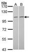 Tubulin Gamma Complex Associated Protein 2 antibody, PA5-21433, Invitrogen Antibodies, Western Blot image 