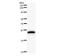 NDC80 Kinetochore Complex Component antibody, LS-C342533, Lifespan Biosciences, Western Blot image 