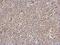 Interleukin 1 Receptor Associated Kinase 4 antibody, GTX113324, GeneTex, Immunohistochemistry paraffin image 