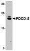 STE20/SPS1-related proline-alanine-rich protein kinase antibody, PA5-20682, Invitrogen Antibodies, Western Blot image 